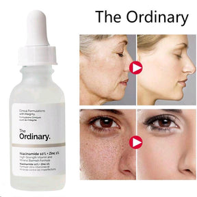 The Ordinary - Niacinamide 10% + Zinc 1% 30mL